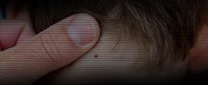 tick bite awareness