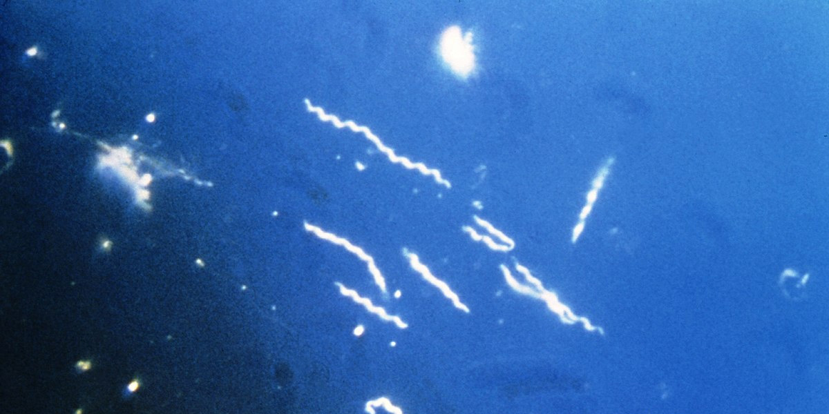 borrelia-burgdorferi